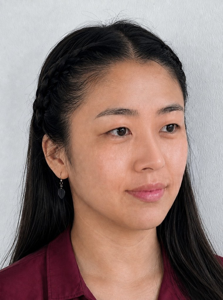 콧대 시술 후 — 같은 사진인데 옆라인 자체가 바뀝니다.