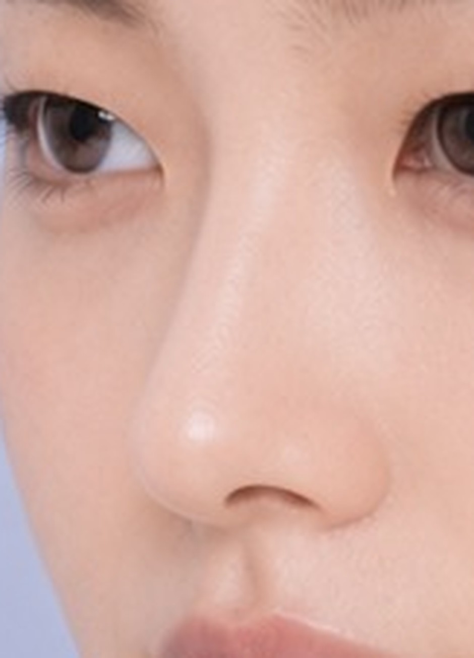 1단계 — 콧대가 서고 코끝이 정리됩니다.