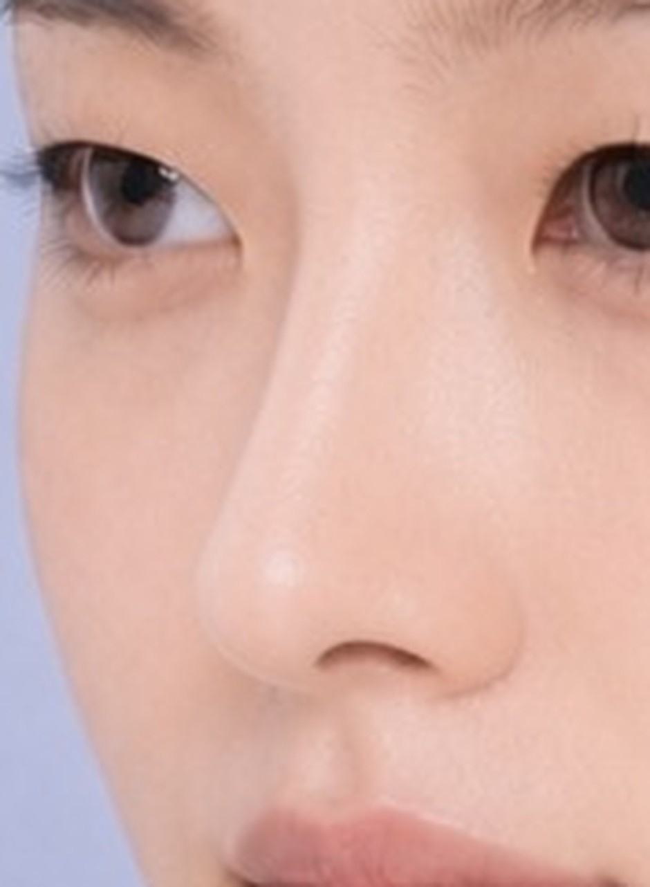 높인 코 — 콧대가 서고 코끝이 올라갔습니다.