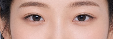 Out-line crease, eye close-up