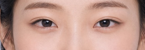 Semi-out-line crease, eye close-up