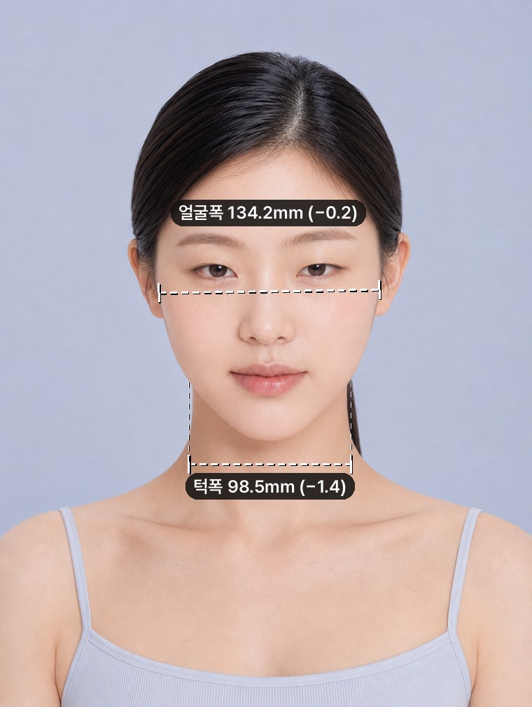 1. V라인 — 턱폭 −1.4mm. 길이는 그대로입니다.