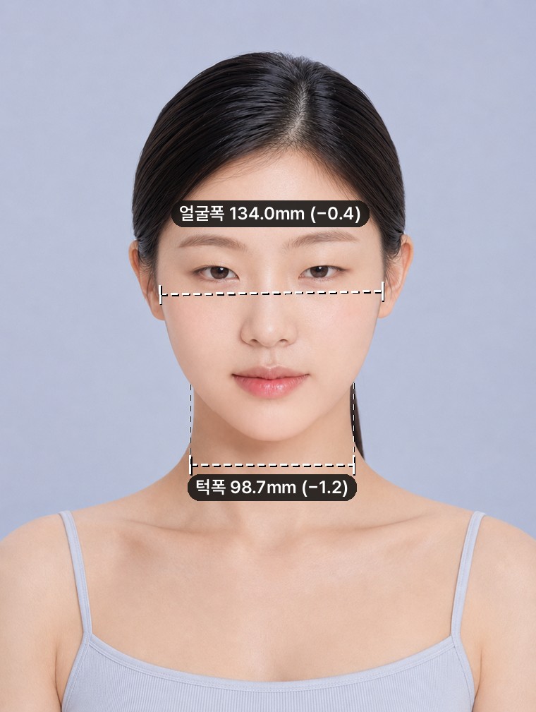 2. + 턱끝 — 하관 길이 −1.4mm. 대신 턱폭 감소가 −1.2mm로 줄었습니다.